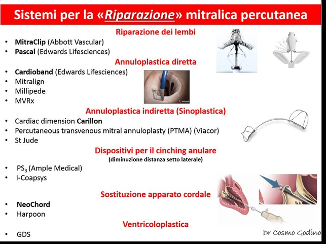 mitraclip1